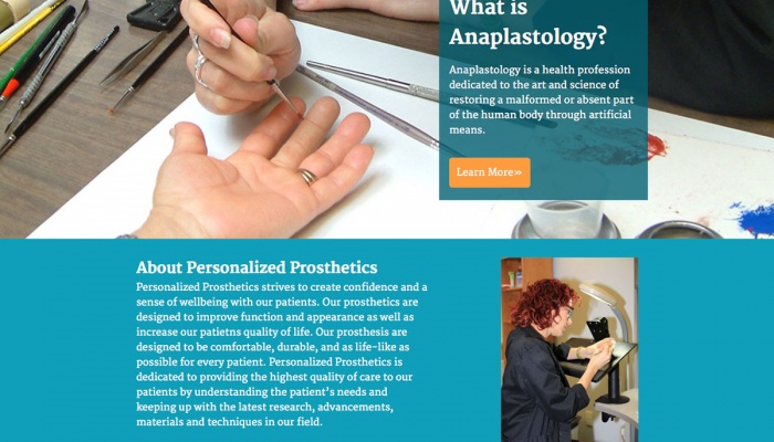 Personalized Prosthetics