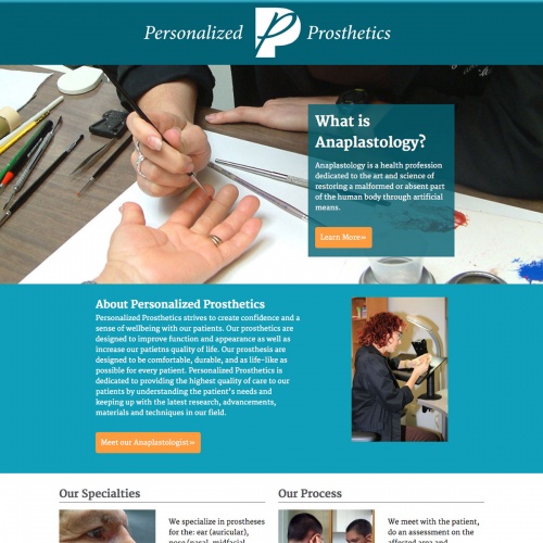 Personalized Prosthetics
